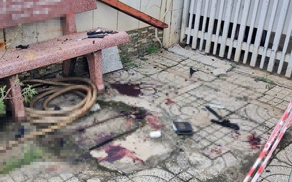 Bàn tay và đùi người đàn ông dập nát sau tiếng nổ lớn