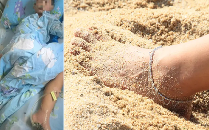 Đi chân trần trên bãi cát, bé trai suýt phải cắt cụt chân