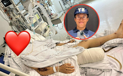 "Có những ngày rất bồn chồn, cố gắng gỡ bỏ ống truyền, như muốn về nhà...": Phản ứng của Bốp khi biết mình đã mất một phần cẳng chân sau tai nạn