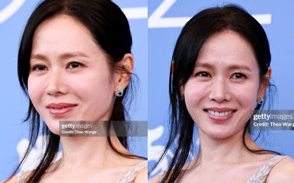 "Quốc bảo nhan sắc" Son Ye Jin làm sao thế này?