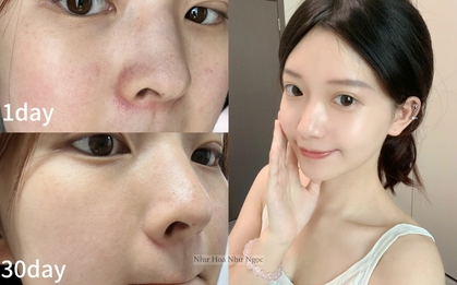 Không chạy theo xu hướng da "trắng sứ", tuổi 35+ tôi nhận ra rằng chỉ cần dưỡng đúng cách thì da sẽ sáng mịn từ bên trong
