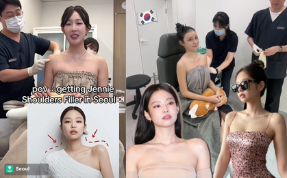 Rộ trào lưu tiêm vai móc áo giống Jennie