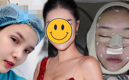 Người mẫu Việt tự khui ảnh thẩm mỹ mặt, thừa nhận rơi khủng hoảng vì sợ biến dạng vĩnh viễn