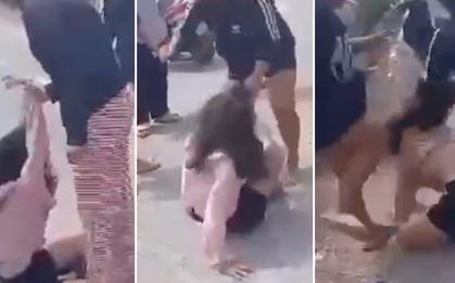 Cần Thơ: Người mẹ bức xúc vì con gái 14 tuổi bị nhóm người đánh bầm dập