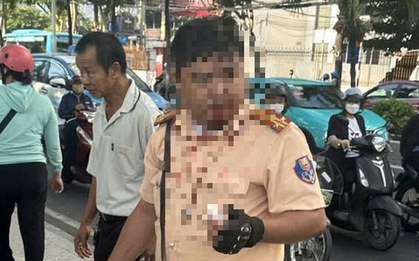 Một cảnh sát giao thông bị thanh niên người Nga tấn công ở Nha Trang