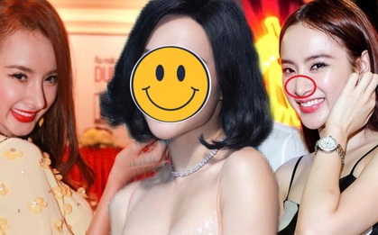 "Nữ hoàng thị phi Vbiz" bị biến dạng mũi, chưa đủ 18 tuổi đã "dao kéo"