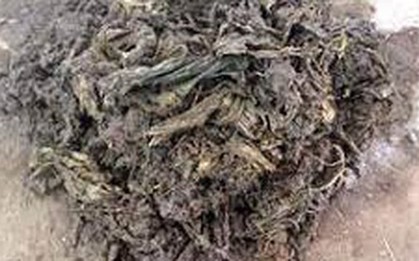 Các bác sĩ sốc nặng khi lấy ra thứ "đáng sợ" nặng 40 kg từ dạ dày con bò hoang