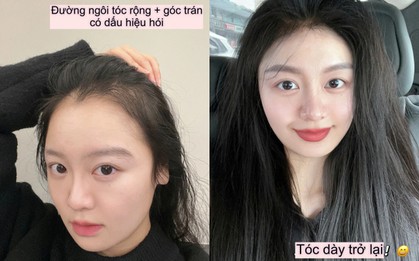 Tôi mất 5 năm để biến mái tóc thưa thớt trở nên dày dặn và bồng bềnh trở lại