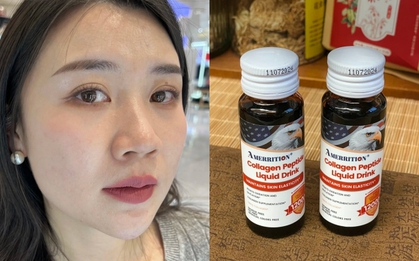 Tôi đã 39 tuổi nhưng da vẫn săn chắc nhờ 7 năm uống collagen