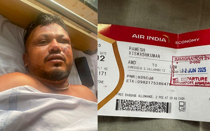 Tình hình hiện tại của người sống sót duy nhất trong thảm kịch máy bay Air India sau 3 tháng