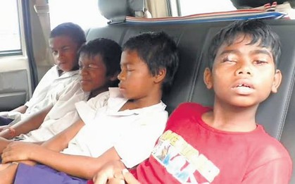 8 học sinh suýt mù vĩnh viễn vì bị bạn cùng phòng nhỏ keo dán vào mắt khi đang ngủ