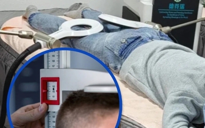 Chi tiền để cao hơn 1,4 cm, thiếu niên bất ngờ nhận 'trái đắng'