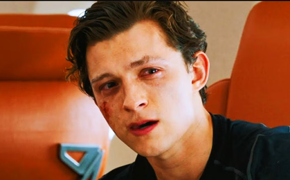 Sao nam đình đám bị chấn động não, “bom tấn” 5.300 tỷ đồng phải tạm dừng