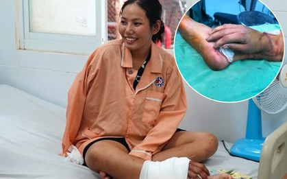 CĐM vỡ òa trước kỳ tích y học Việt Nam: Thai phụ bị tai nạn, được ghép tạm bàn tay đứt lìa vào chân chờ ngày nối lại