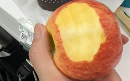 Cắn 1 quả táo nguyên mỗi ngày, 3 tháng bé gái khỏi hẳn bệnh