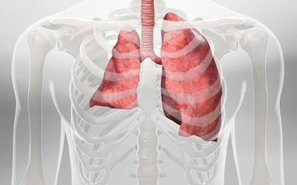 Đang khỏe mạnh bỗng bị xẹp phổi, thanh niên 24 tuổi hối hận vì đã làm 1 điều suốt gần 10 năm