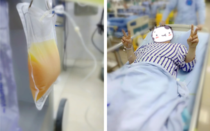 Người đàn ông máu "trắng đục như sữa" sau bữa ăn nhiều cua và bánh trung thu