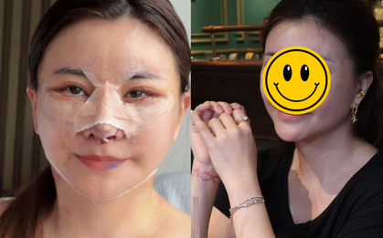 Nữ diễn viên Việt vừa phẫu thuật thẩm mỹ mặt ở Hàn Quốc bị chê mạnh, phải vội lên tiếng làm rõ 1 thông tin