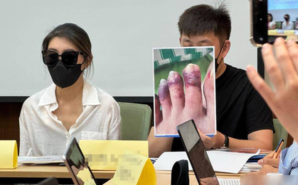 Đi hút mỡ, người phụ nữ phải chạy thận nhân tạo suốt đời