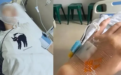 Dầm mưa 10 phút, người phụ nữ bị viêm màng não