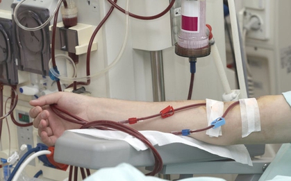 Cô gái 22 tuổi suy thận, ngừng tim sau khi uống thứ này liên tục 4 năm: Bác sĩ nói "nên bỏ ngay"