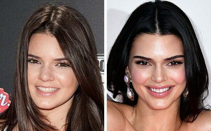 Kendall Jenner mà đẹp tự nhiên sao?