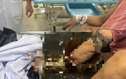 Người đàn ông vác cả máy xay thịt đến bệnh viện cấp cứu