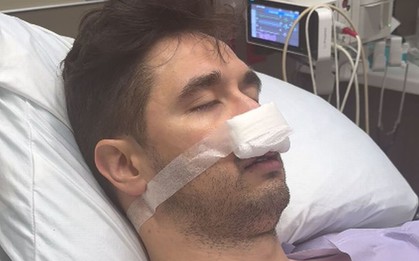 Tỉnh dậy sau phẫu thuật, người đàn ông Mỹ bỗng nhiên nói tiếng Tây Ban Nha trôi chảy dù trước đó chỉ biết đếm đến 10