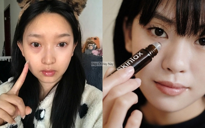 4 dưỡng mắt "made in Vietnam" giúp giảm quầng thâm thấy rõ