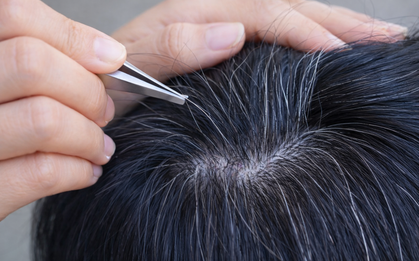 Một thói quen phổ biến ai bị tóc bạc cũng làm khiến tóc càng bạc, càng thưa