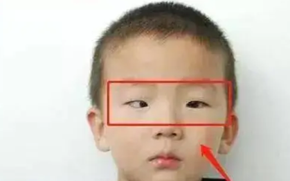 Bé 5 tuổi chơi game trong thời gian dài, tròng đen dần biến mất, bác sĩ cảnh báo rất khó phục hồi