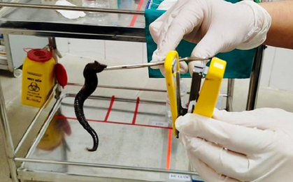 Đi khám, người đàn ông sốc nặng khi thấy thứ đáng sợ trong mũi mình