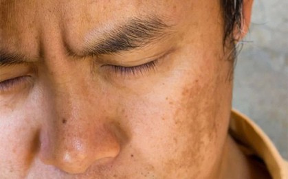 Cơ thể xuất hiện 4 biểu hiện bất thường này vào buổi sáng cảnh báo gan đang mang “mầm bệnh”: Có 3/4 thì phải đi khám ngay