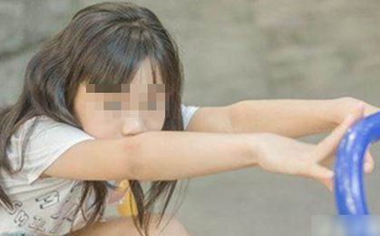 Bé gái 7 tuổi dậy thì sớm sau 3 tháng ăn uống theo cách nhiều cha mẹ đang làm