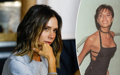 Victoria Beckham đã phải chịu đựng căn bệnh này suốt 25 năm qua