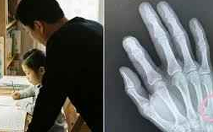 Con viết 18 chữ sau 30 phút học, người cha tức giận đập bàn… và cái kết khó tin