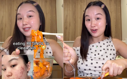 Bát salad 5’ tạo retinol dồi dào, mặt giảm hẳn mụn mà da vẫn lành