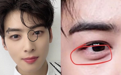 "Gương mặt thiên tài" của Cha Eun Woo là giả dối nốt?