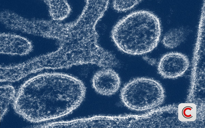 Nipah 2026: "Sát thủ" có tỷ lệ tử vong 40-75%, chưa có vaccine đặc hiệu