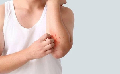 Người đàn ông 40 tuổi phát hiện ung thư gan giai đoạn cuối: Đáng tiếc ông đã bỏ qua dấu hiệu suốt 3 tháng