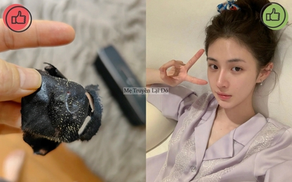 Mẹ tôi từng mua đủ thứ để chăm da, bà bảo tôi rằng có 5 món không nên dùng vì sẽ khiến da xấu đi