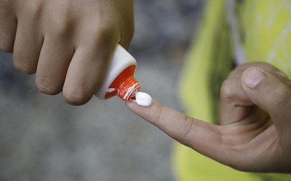 Bộ Y tế đình chỉ lưu hành, thu hồi toàn quốc loại kem bôi da do tên gây hiểu nhầm là thuốc