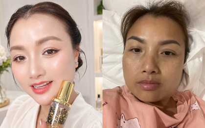 Quỳnh Trần JP bị tố quảng cáo serum quá lố vì màn ghép mặt xài app và mặt mộc: Động thái gây chú ý