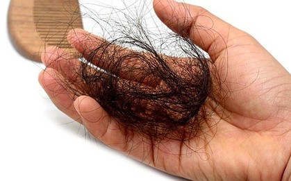 Lời khuyên cho những ai hay bị rụng tóc