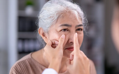 Gan nhiễm mỡ có thể nhận biết qua khuôn mặt: 3 dấu hiệu trên cơ thể cảnh báo bệnh, bao gồm cả đường chỉ tay và lưỡi