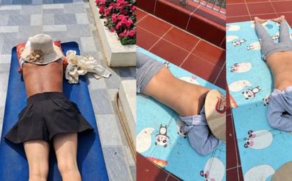 Cảnh báo nguy cơ sức khỏe từ trào lưu "phơi nắng giữa trưa"