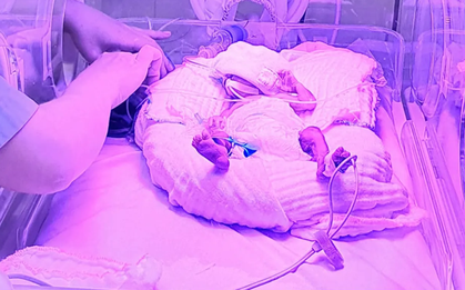 Nhận biết sớm dấu hiệu suy hô hấp ở trẻ sơ sinh