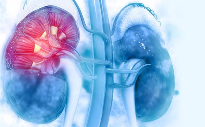 Chuyên gia Mỹ: Đây là dấu hiệu đầu tiên của bệnh thận, chớ nên bỏ qua
