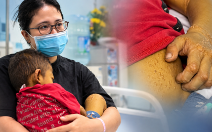 Con 4 tuổi da vàng như nghệ phải thay gan: Mẹ “sốc” khi biết căn bệnh phía sau
