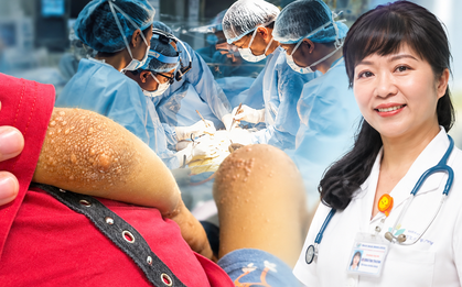 "Bác thương con, cắt hết mấy cục u này cho con nhé!”: Lời nói khiến bác sĩ xúc động của bé trai 4 tuổi